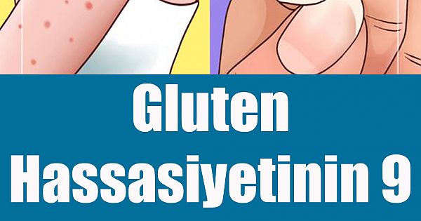 Gluten Hassasiyetinin 9 Beliirtisi 