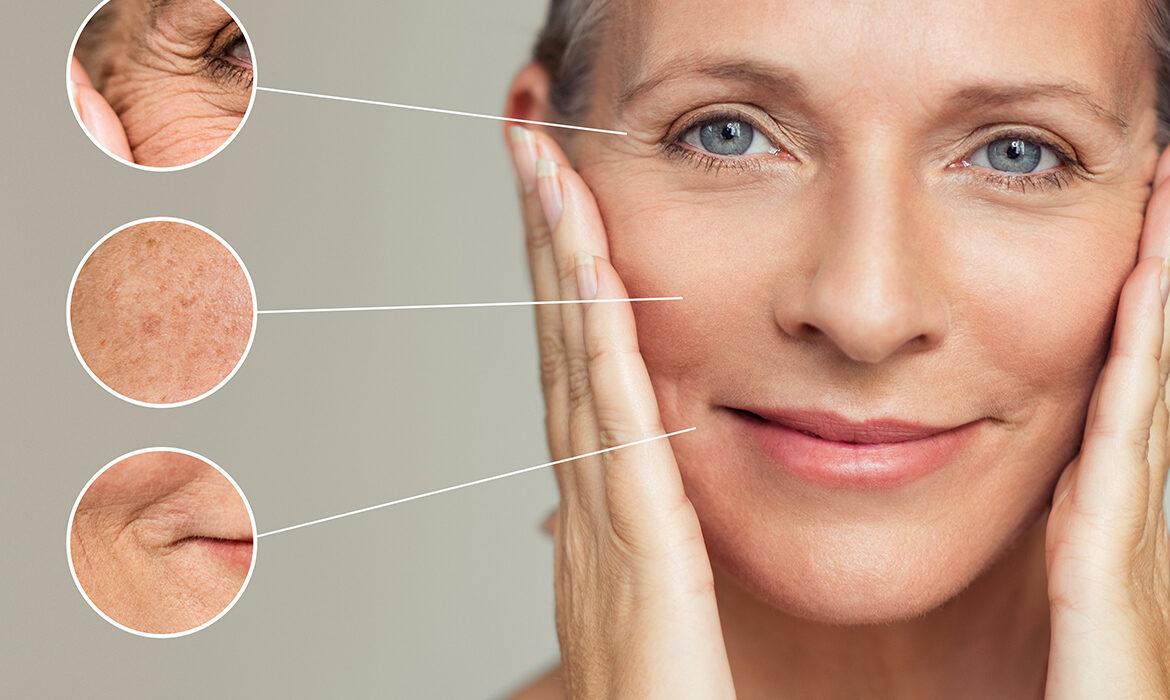 Fotoyaşlanma (Photoaging) Nedir?