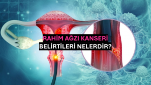 Rahim Ağzı Kanseri Belirtileri Nelerdir?