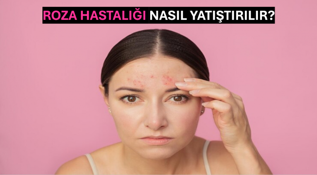 Roza Hastalığı Nasıl Yatıştırılır?