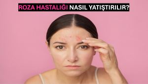 Roza Hastalığı Nasıl Yatıştırılır?