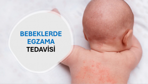 Bebeklerde Egzama Tedavisi